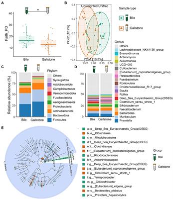 Landscape in the gallbladder mycobiome and bacteriome of patients undergoing cholelithiasis with chronic cholecystitis